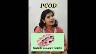 PCOD, #drrenukahomeopathy #homeopathicmedicine, Polycystic Ovarian disease, irregular menses