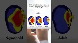 Mobile Phone Radiation & Baby Brain Development | Important Message for Parents #lahoredoctors