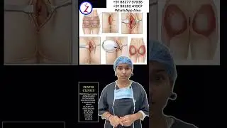Buttock Implant In Mumbai | Buttock Implant Surgery In Mumbai | Zenith Clinic