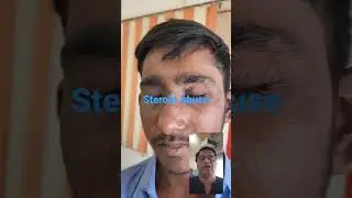 #steroids Abuse #Dr Bhutada #english #ytshortsfeatures