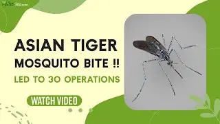 Asian Tiger Mosquito Bite: Man Undergoes 30 Operations, After Mosquito Bite !!