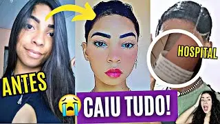 PERDEU O CABELO E FOI PARAR NO HOSPITAL! ELA MISTUROU PROGRESSIVAS E TEVE REAÇÃO ALÉRGICA!