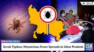 Scrub Typhus: Mysterious Fever Spreads in Uttar Pradesh