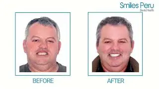 Tomasoni&rsquo;s Experience at Smiles Peru