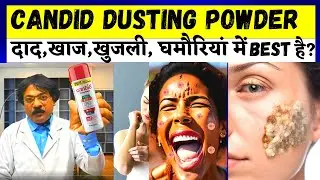 Clotrimazole Dusting Powder | दाद,खाज,खुजली घमौरियां में उपयोगी Candid Powder Review | candid powder