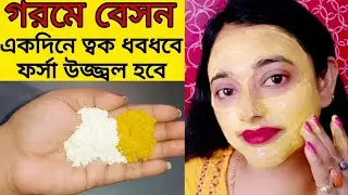 গরমে বেসন এইভাবে মাখো ১দিনে কালোদাগ দূর হয়ে ত্বক ধবধবে ফর্সা উজ্জ্বল হবে/besan face pack/whitening