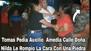 Urgente🚨doña Nilda Le Rompio La Cara A Tomas Con Una Piedra.Tomas Pedia Auxilio amedia Calle 