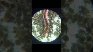 What it looks like when a bloodworm has a 7-Course meal: