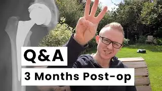 Q&A: 3 months Post Hip Replacement Surgery (35m, UK, Posterior Approach, Athlete)