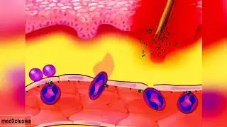 Inflammatory Response [Introduction]