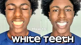 The BEST Teeth Whitening Method That Actually Works (At Home)