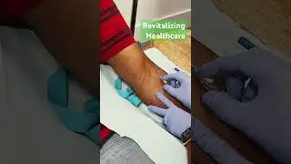 IV Catheter Insertion
