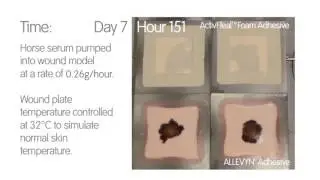 Foam Dressing Comparison - ALLEVYN Adhesive vs ActivHealTM Adhesive