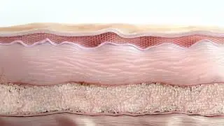 ULTHERA PRIME de Merz Aesthetics