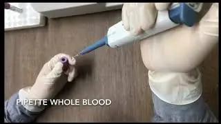 𝐀𝐋𝐒𝐀𝐓 𝐅𝐀 𝟓𝟎 -True Point of care testing device. 𝑼𝑺 𝐅𝐃𝐀 𝐂𝐞𝐫𝐭𝐢𝐟𝐢𝐞𝐝. - Fast results in 3-15 minutes