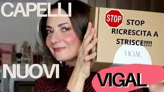 BASTA RICRESCITA A STRISCE, PRURITO E COLORE FINTO: COME HO AVUTO CAPELLI NUOVI E MORBIDI CON VIGAL