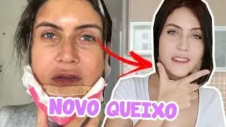 MINHA CIRURGIA PLÁSTICA NA COREIA DO SUL (V LINE) - 21 DIAS DEPOIS (MUDEI MUITO!!!)