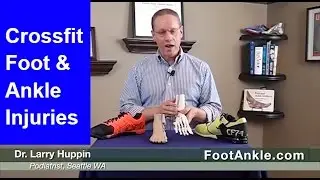 CrossFit Foot and Ankle Injuries &ndash; Staying Fit While Recovering | Seattle Podiatrist