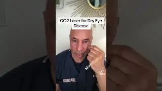 Fractionated CO2 laser for dry eye disease