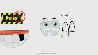 Dental Implant Information for San Diego