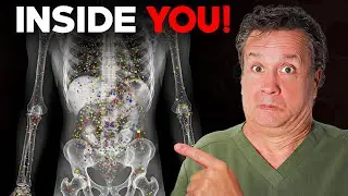 This Is What MICROPLASTICS Do To Your Body