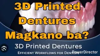 3D Printed Dentures Price, Magkano nga ba?