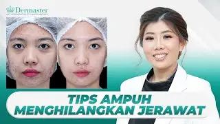 HILANGKAN JERAWAT SECARA ALAMI & PERAWATAN | Meet The #BeautyExpert : Episode 26