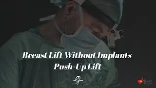 Implant-Free Breast Lift Explained | Push-Up Lift Technique