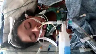 McKay-Dee Hospital Inpatient Rehab &ndash; Marjorie&rsquo;s Story