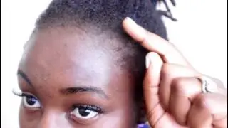 30 Day Castor Oil Challenge Update