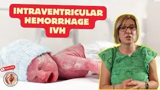 Intraventricular hemorrhage IVH