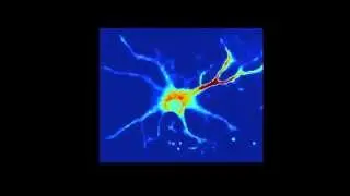 Astrocyte branches Calcium signalling