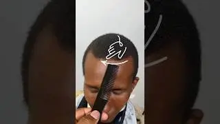 Устранение отступающих волос за 100 долларов ‼️😫💈
