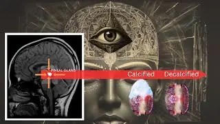 Once You Activate Your Third Eye: Reality is Yours | Ancient Methods to Decalcify the Pineal Gland