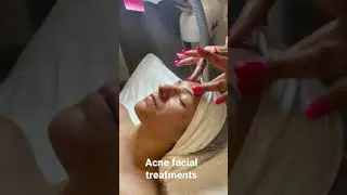 Acne facial treatments Montreal