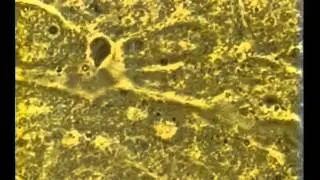 Effect of BEMER on circulation in Liver
