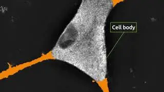 Morphological evolution of cortical neuron cells over time under Nanolive live cell imaging solution