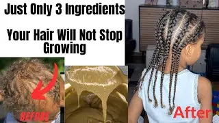 Just Only 3 Ingredients | Your Hair Will not Stop Growing| Twice A Month For Extreme Results|