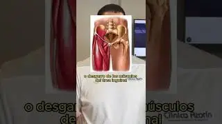 Esta lesi&oacute;n en muy com&uacute;n en deportistas: &iquest;Qu&eacute; es la distensi&oacute;n inguinal?