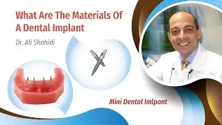 What Are The Materials Of A Dental Implant