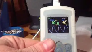 New UYB Oximetry Sensor set up with VM-2160 Handheld Pulse Oximiter