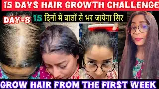 Grow Hair From The First Week👍Indian Secrets🤫Ganjapan Dur Karne Wala Toner💕Day-8#haircare#viralvideo