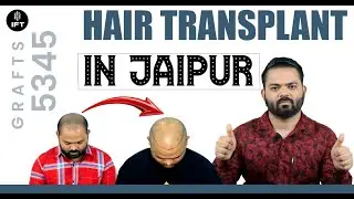 Hair Transplant In Jaipur | Cost of Hair Transplant | IFT Hair Science
