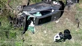 Tiger Woods hospitalized after car accident