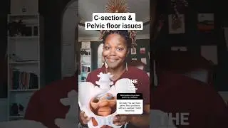 Pelvic floor issues after a C-section 🤯 #pelvicfloorphysicaltherapy #csection #pelvicfloorhealth