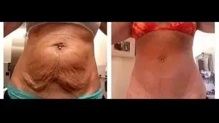 New Nerium Brand Partner