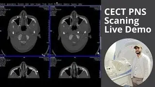 How To Do CECT PNS Scanning Egy Matter ||@mumtazmritechnologist
