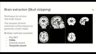 8.0 - MRI brain extraction with Python and CNNs - Course MRI preprocessing with Python