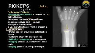 UG Lecture 4 (Part 2) : Bones - Metabolic