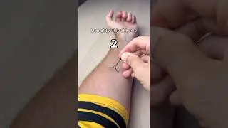 How to Make Mosquito Snapper 😭